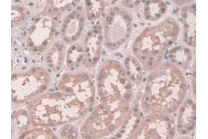 IHC-P analysis of Human Kidney Tissue, with DAB staining. (Connexin 43/GJA1 抗体  (AA 180-382))