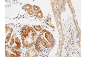 IHC-P Image Immunohistochemical analysis of paraffin-embedded human gastric , using GLOD4, antibody at 1:100 dilution. (GLOD4 抗体)