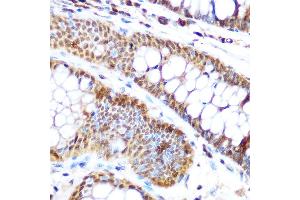 Immunohistochemistry of paraffin-embedded human colon using SP3 Rabbit pAb (ABIN6130701, ABIN6148314, ABIN6148315 and ABIN6216542) at dilution of 1:100 (40x lens). (Sp3 抗体  (AA 240-350))