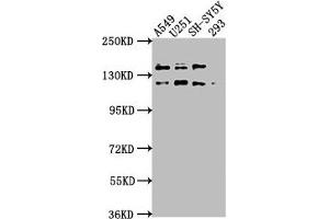 Western Blot Positive WB detected in: A549 whole cell lysate, U251 whole cell lysate, SH-SY5Y whole cell lysate, 293 whole cell lysate All lanes: TAOK1 antibody at 1:2000 Secondary Goat polyclonal to rabbit IgG at 1/50000 dilution Predicted band size: 117, 47, 98 kDa Observed band size: 117 kDa (TAO Kinase 1 (TAOK1) (AA 400-659) 抗体)
