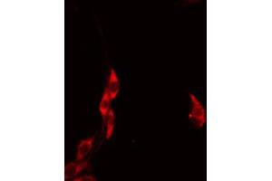 ABIN6274612 staining HeLa by IF/ICC. (HCCS 抗体  (Internal Region))