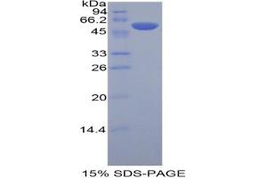 SDS-PAGE (SDS) image for Killer Cell Immunoglobulin-Like Receptor, three Domains, Long Cytoplasmic Tail, 2 (KIR3DL2) protein (ABIN3010365)
