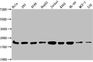 Western Blot Positive WB detected in: Hela whole cell lysate, 293 whole cell lysate, A549 whole cell lysate, HepG2 whole cell lysate, Jurkat whole cell lysate, K562 whole cell lysate, HL60 whole cell lysate, MCF-7 whole cell lysate, LO2 whole cell lysate All lanes: HIST1H1C antibody at 1:500 Secondary Goat polyclonal to rabbit IgG at 1/40000 dilution Predicted band size: 22 kDa Observed band size: 22 kDa (HIST1H1C 抗体  (meLys186))