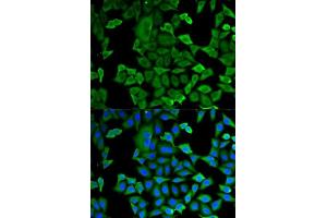 Immunofluorescence analysis of MCF-7 cells using GAPDH antibody. (GAPDH 抗体  (AA 1-335))