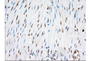 Immunohistochemical staining of paraffin-embedded Human colon tissue using anti-EIF2S1 mouse monoclonal antibody. (EIF2S1 抗体)