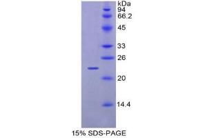 SDS-PAGE (SDS) image for Glucosidase, Alpha, Acid (GAA) (AA 755-953) protein (His tag) (ABIN2121123) (GAA Protein (AA 755-953) (His tag))