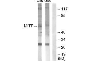 Western blot analysis of extracts from HepG2 cells (lane 1) and COLO205 cells (lane 2), using MITF (epitope around residue 180/73) antibody.
