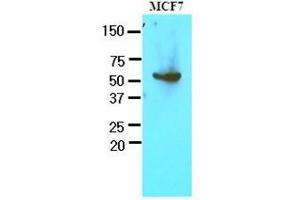 Western Blotting (WB) image for anti-Glucose-6-Phosphate Dehydrogenase (G6PD) (AA 35-506) antibody (ABIN400862) (Glucose-6-Phosphate Dehydrogenase 抗体  (AA 35-506))