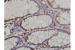 Image no. 2 for anti-CDK5 Regulatory Subunit Associated Protein 3 (CDK5RAP3) (AA 1-507) antibody (ABIN599311) (CDK5RAP3 抗体  (AA 1-507))