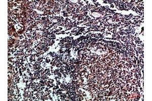 Immunohistochemical analysis of paraffin-embedded Human-tonsil, antibody was diluted at 1:100 (IL17D 抗体  (AA 141-190))