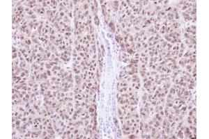 IHC-P Image Immunohistochemical analysis of paraffin-embedded DLD1 Xenograft, using RAG2, antibody at 1:100 dilution. (RAG2 抗体  (Center))