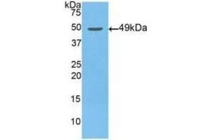 Detection of Recombinant NSE, Human using Polyclonal Antibody to Enolase, Neuron Specific (NSE) (ENO2/NSE 抗体  (AA 2-285))