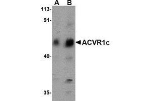 Western Blotting (WB) image for anti-Activin Receptor Type 1C (ACVR1C) (N-Term) antibody (ABIN1031213) (ACVR1C/ALK7 抗体  (N-Term))