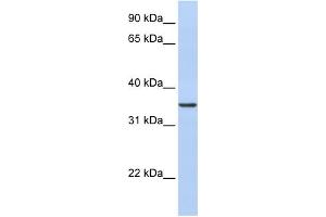 WB Suggested Anti-CDC42EP4 Antibody Titration: 0. (CDC42EP4 抗体  (N-Term))