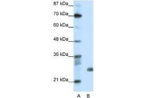 WB Suggested Anti-SAP30 Antibody Titration:  1. (SAP30 抗体  (N-Term))