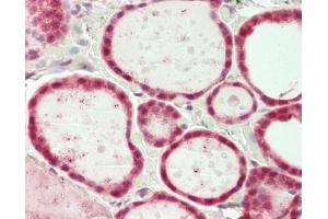 Human Thyroid: Formalin-Fixed, Paraffin-Embedded (FFPE)