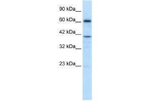 WB Suggested Anti-PRDM14 Antibody Titration: 1. (PRDM14 抗体  (Middle Region))