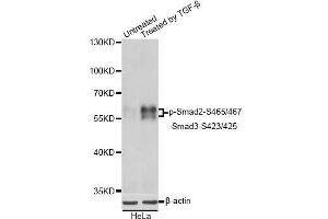 Western blot analysis of extracts of HeLa cells, using Phospho-Smad2-S465/467/-Smad3-S423/425 antibody. (SMAD2 / SMAD3 (pSer423), (pSer425) 抗体)