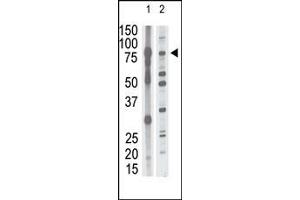 The anti-P15 N-term Antibody (ABIN390139 and ABIN2840643) is used in Western blot to detect P15 in mouse brain tissue lysate (lane 1) and HL60 cell lysate (lane 2) lysate. (MMP15 抗体  (N-Term))