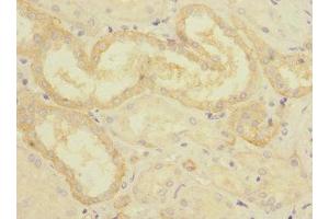 Immunohistochemistry of paraffin-embedded human kidney tissue using ABIN7149302 at dilution of 1:100 (CRLF2 抗体  (AA 23-231))