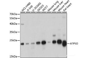 Western blot analysis of extracts of various cell lines using ATP5O Polyclonal Antibody at dilution of 1:1000. (ATP5O 抗体)