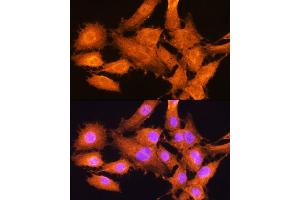 Immunofluorescence analysis of C6 cells using AIRE Rabbit pAb (ABIN3022514, ABIN3022515, ABIN3022516 and ABIN6218869) at dilution of 1:100. (AIRE 抗体  (AA 30-130))