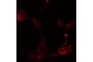 ABIN6274886 staining HeLa cells by IF/ICC. (ABCF1 抗体  (C-Term))