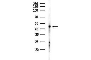 anti-Zinc Binding Alcohol Dehydrogenase Domain Containing 2 (ZADH2) (Internal Region) antibody
