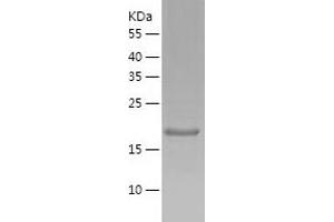 Western Blotting (WB) image for Fibroblast Growth Factor 18 (FGF18) (AA 28-207) protein (His tag) (ABIN7122926) (FGF18 Protein (AA 28-207) (His tag))