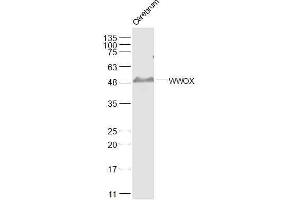 Mouse cerebrum lysates probed with WWOX Polyclonal Antibody, Unconjugated  at 1:500 dilution and 4˚C overnight incubation. (WWOX 抗体  (AA 5-100))
