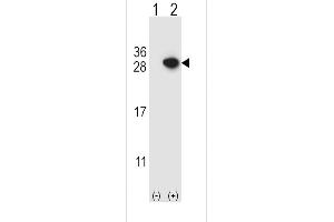 Western blot analysis of ARHGDIA using rabbit polyclonal ARHGDIA Antibody using 293 cell lysates (2 ug/lane) either nontransfected (Lane 1) or transiently transfected (Lane 2) with the ARHGDIA gene. (ARHGDIA 抗体  (C-Term))
