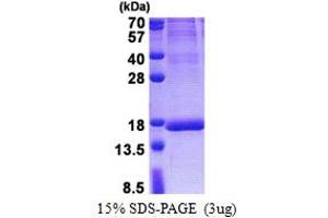 SDS-PAGE (SDS) image for Isochorismatase Domain Containing 2 (ISOC2) (AA 59-205) protein (His tag) (ABIN5853185) (ISOC2 Protein (AA 59-205) (His tag))