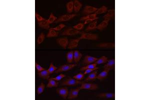 Immunofluorescence (IF) image for anti-B-Cell CLL/lymphoma 2 (BCL2) antibody (ABIN7265809)