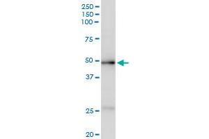 Immunoprecipitation of ACADM transfected lysate using anti-ACADM MaxPab rabbit polyclonal antibody and Protein A Magnetic Bead , and immunoblotted with ACADM purified MaxPab mouse polyclonal antibody (B01P) . (Medium-Chain Specific Acyl-CoA Dehydrogenase, Mitochondrial (MCAD) (AA 1-421) 抗体)