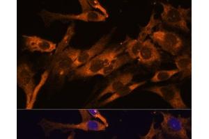 Immunofluorescence analysis of C6 cells using RPL36AL Polyclonal Antibody at dilution of 1:100 (40x lens). (RPL36AL 抗体)