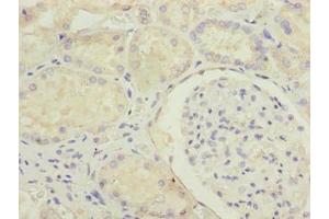 Immunohistochemistry of paraffin-embedded human kidney tissue using ABIN7159124 at dilution of 1:100 (MED22 抗体  (AA 2-140))