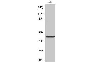 Western Blotting (WB) image for anti-PRP18 Pre-mRNA Processing Factor 18 (PRPF18) (Internal Region) antibody (ABIN3186566)