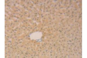 IHC-P analysis of Mouse Liver Tissue, with DAB staining. (SFTPB 抗体  (AA 20-193))