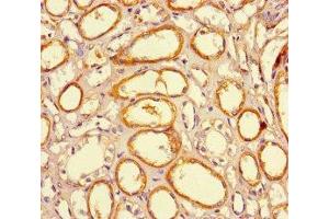 Immunohistochemistry of paraffin-embedded human kidney tissue using ABIN7165672 at dilution of 1:100 (JARID2 抗体  (AA 1-159))