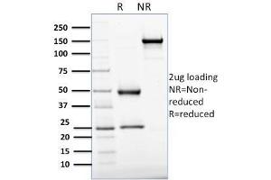 SDS-PAGE Analysis Purified APEX Nuclease I Mouse Monoclonal Antibody (CPTC-APEX1-2).