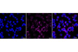 Immunocytochemical staining of Hela cells with Galactosidase alpha antibody (ABIN7798683), 1:1,000).