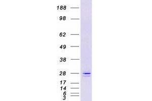 Western Blotting (WB) image for Endoplasmic Reticulum Protein 29 (ERP29) (Transcript Variant 1) protein (Myc-DYKDDDDK Tag) (ABIN2720506)