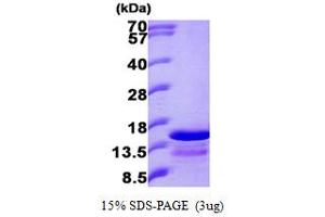 SDS-PAGE (SDS) image for Ghrelin (GHRL) (AA 24-117) protein (His tag) (ABIN666671) (Ghrelin Protein (GHRL) (AA 24-117) (His tag))