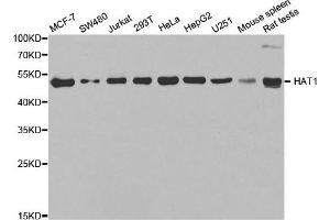 Western Blotting (WB) image for anti-Histone Acetyltransferase 1 (HAT1) antibody (ABIN1882320) (HAT1 抗体)
