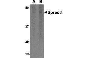 Western Blotting (WB) image for anti-Sprouty-Related, EVH1 Domain Containing 3 (SPRED3) (Middle Region) antibody (ABIN1031104) (SPRED3 抗体  (Middle Region))