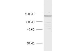 dilution: 1 : 1000, sample: rat retina extract (MPP5 抗体  (AA 2-244))