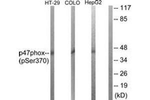 Western Blotting (WB) image for anti-Neutrophil Cytosol Factor 1 (NCF1) (AA 341-390), (pSer370) antibody (ABIN482334) (NCF1 抗体  (pSer370))