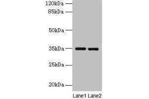 Western blot All lanes: Thpo antibody at 4 μg/mL Lane 1: Mouse liver tissue Lane 2: 293T whole cell lysate Secondary Goat polyclonal to rabbit IgG at 1/10000 dilution Predicted band size: 35 kDa Observed band size: 35 kDa (Thrombopoietin 抗体  (AA 22-194))