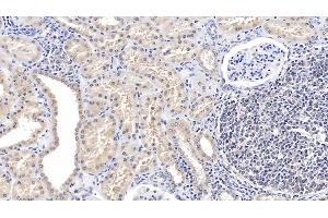 Immunohistochemistry (IHC) image for anti-GDNF Family Receptor alpha 1 (GFRA1) (AA 239-350) antibody (ABIN7430060)