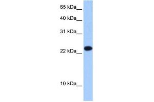EIF4E3 antibody used at 0. (EIF4E3 抗体  (Middle Region))